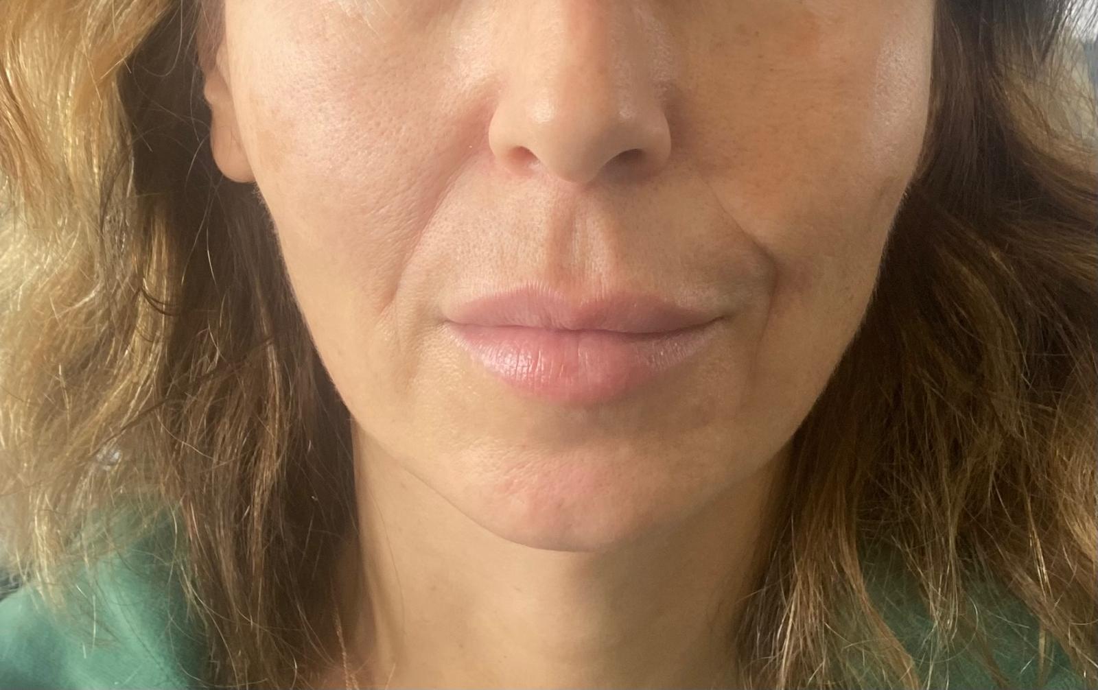 Organic Beauty Boost Treatments