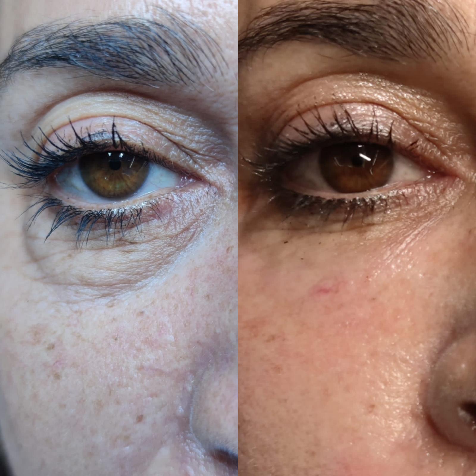 Advanced Skin Treatments